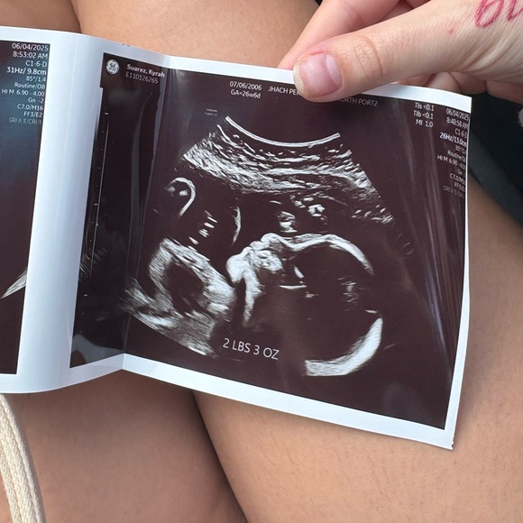 PURCHASE YOUR TICKET FOR DIAPERS & WIPES, GOODLUCK & TYSM ๐ผ๐ผ๐คฑ - Picture 10 of 14